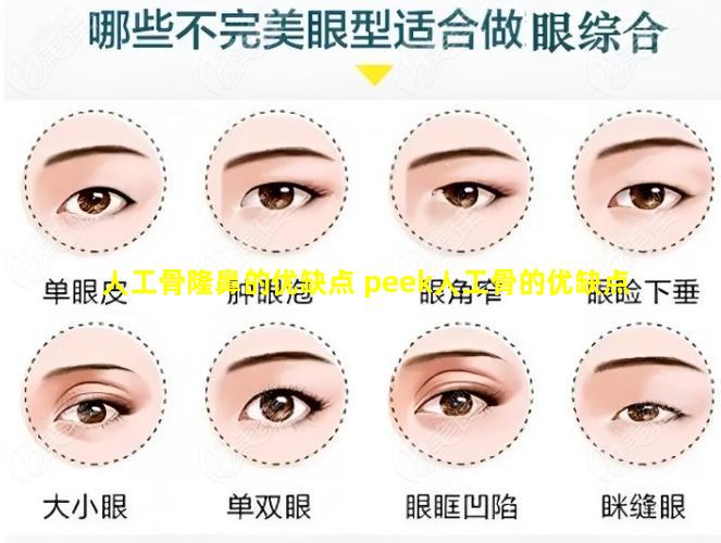 人工骨隆鼻的优缺点 peek人工骨的优缺点